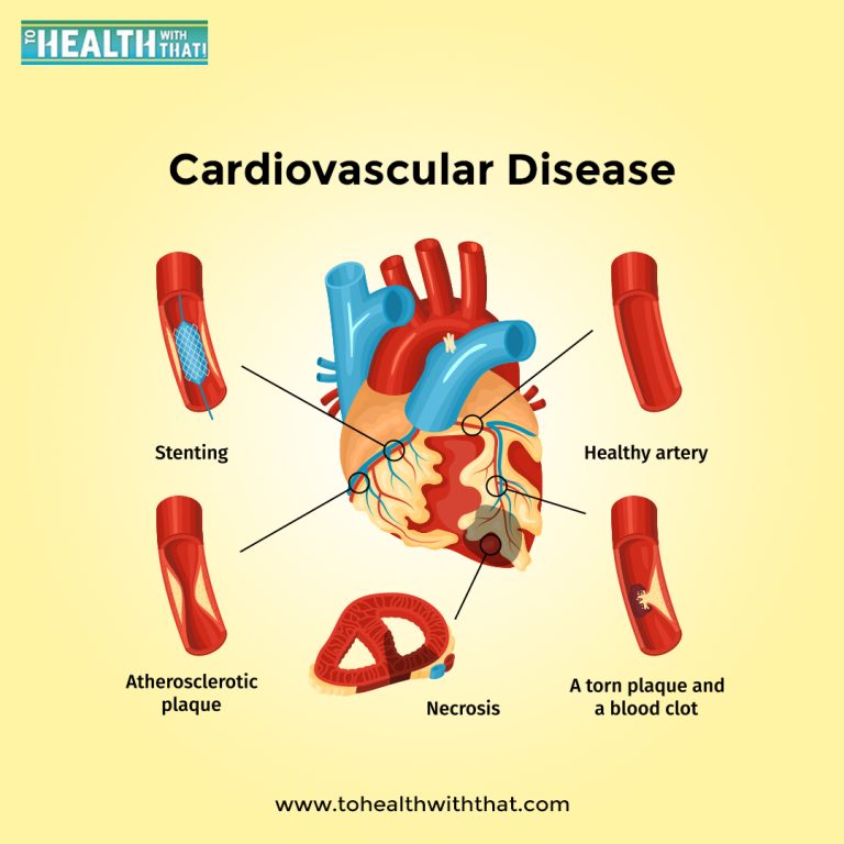 A detailed guide to cardiovascular disease