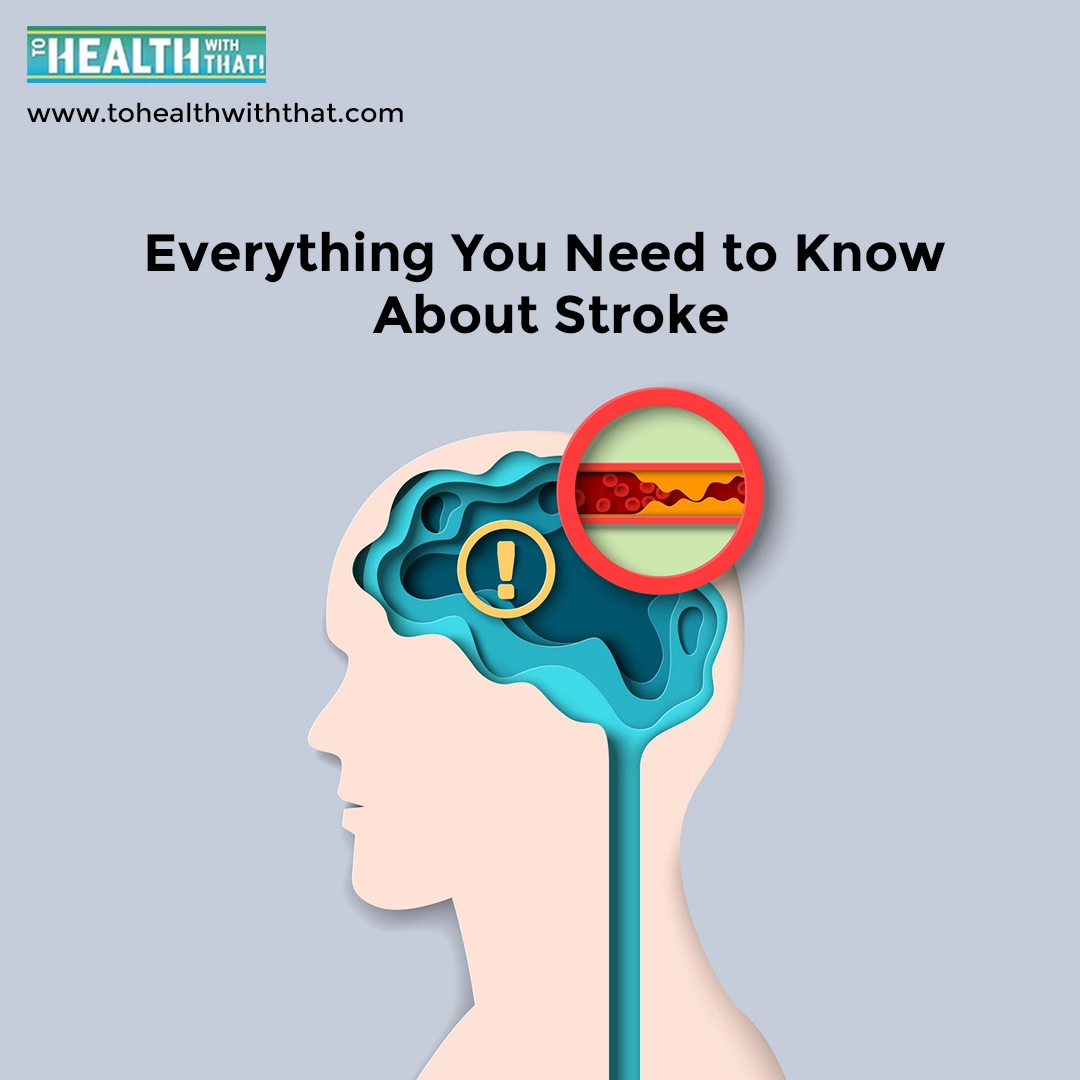 Stroke: Everything You Need to Know
